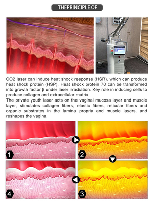 Hot Selling Wholesale CO2 Fractional Laser Equipment +vaginal laser+ cutting laser