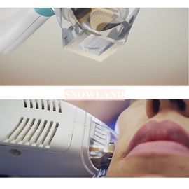 Tixel Fractional Machine For Acne Scar Removal With Perfect Treatment Result