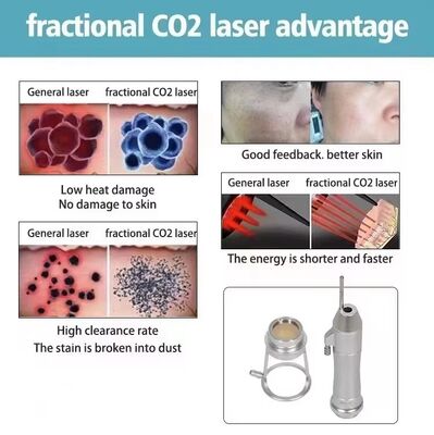 Snowland Factory OEM New Metal RF Tube Fractional Co2 Laser Red Pointer for Co2 Machine Acne Scars Removal Pigment Removal Face Lifting
