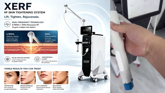New XERF Dual Frequency RF Skin Tightening Machine 6.78MHz & 2MHz Monopolar RF Anti-Aging Device XERF Machine